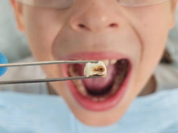 Best Broken or Chipped Tooth Repair in Evergreen, CO